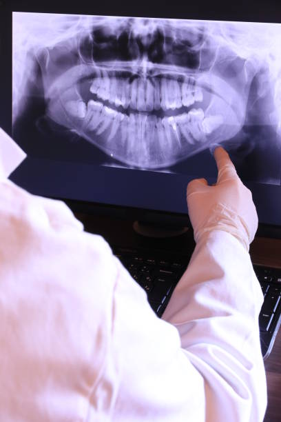 Best Broken or Chipped Tooth Repair in Rifle, CO