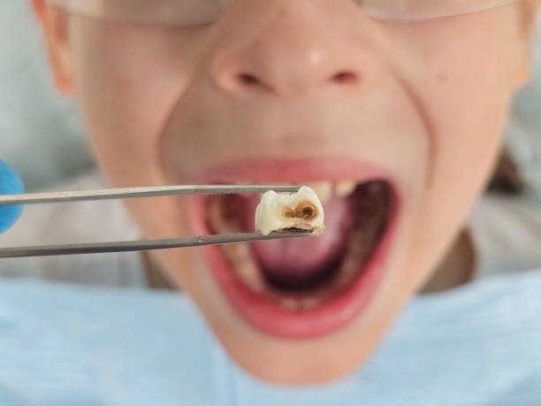 Professional Emergency Dental Service in CO